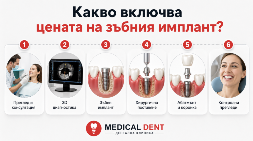 Инфографика за елементите, включени в цената на зъбния имплант